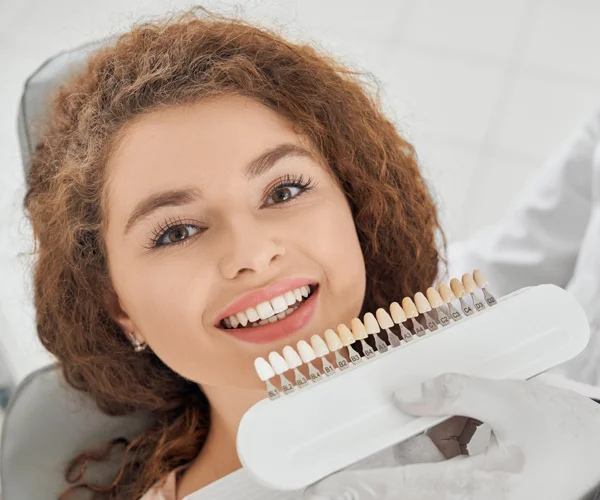 Composite Veneers