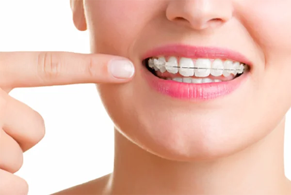 Orthodontic Treatment