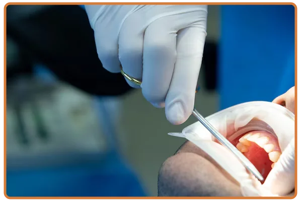 Gum Surgeries