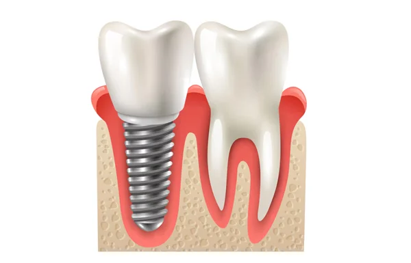 Bone Manipulation